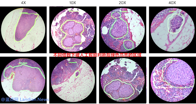 谷歌通过人工智能建立 AR 癌症研究与检测显微镜原型